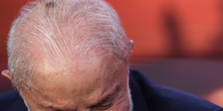 Lula passa por consulta de acompanhamento após cirurgia de câncer de pele